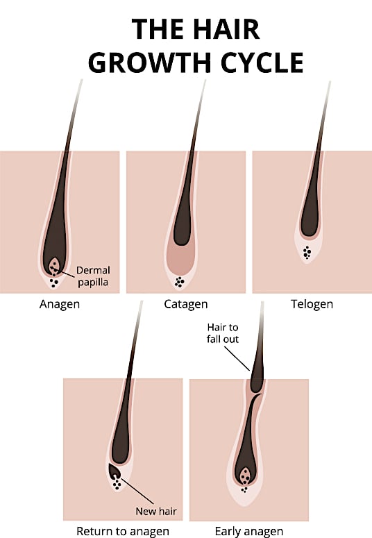 Electrolysis Picture Electrolysis Picture